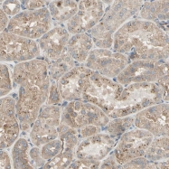 NBP1-86823 - ZP4 / ZPB