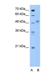 NBP1-69341 - ZP4 / ZPB