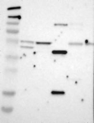NBP1-86823 - ZP4 / ZPB