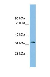 NBP1-57768 - ZPBP2