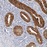 NBP1-86917 - ZRANB1