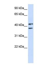 NBP1-57524 - ZRANB2