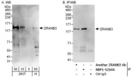 NBP1-52644 - ZRANB3