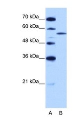 NBP1-57317 - ZRSR2