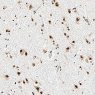 NBP1-85184 - ZSCAN16