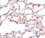 NBP1-77120 - ZSCAN4