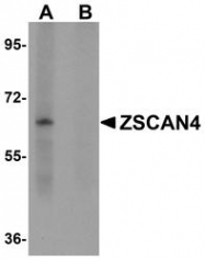 NBP1-77120 - ZSCAN4