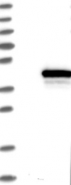 NBP1-82868 - ZW10 interactor / ZWINT