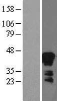 NBL1-07871 - Zinc Alpha 2 Glycoprotein Lysate