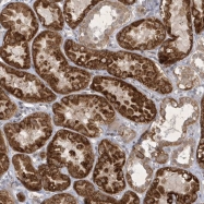 NBP1-92611 - ZBTB9
