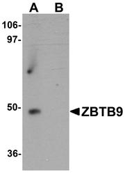 NBP1-76522 - ZBTB9