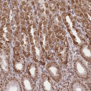 NBP1-82026 - ZMAT2