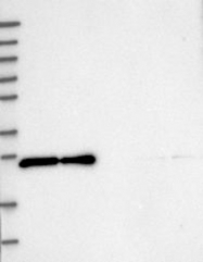 NBP1-82026 - ZMAT2