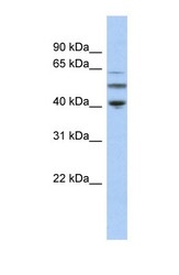 NBP1-53014 - alpha Tubulin / TUBA3C / TUBA2