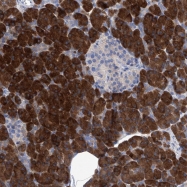 NBP1-80613 - XPNPEP1