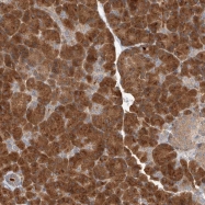 NBP1-80615 - XPNPEP1