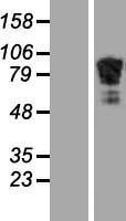 NBL1-07332 - beta Adducin Lysate