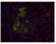 NBP1-78007 - Amyloid beta