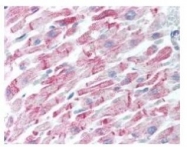 NBP1-78007 - Amyloid beta