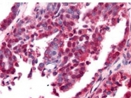NBP1-78007 - Amyloid beta