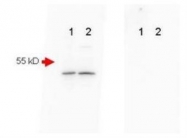 NBP1-78007 - Amyloid beta
