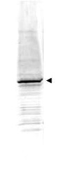 NBP1-78007 - Amyloid beta