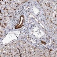 NBP1-87511 - Beta-glucuronidase