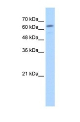 NBP1-69355 - Beta-glucuronidase