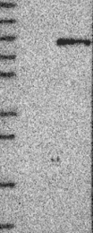 NBP1-87511 - Beta-glucuronidase