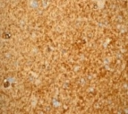 NB100-79903 - Beta-Synuclein / SCNB