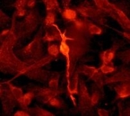 NB100-79903 - Beta-Synuclein / SCNB