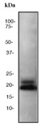 NB100-79903 - Beta-Synuclein / SCNB