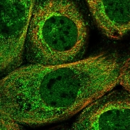 NBP1-90342 - Beta-Synuclein / SCNB