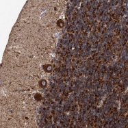 NBP1-90342 - Beta-Synuclein / SCNB