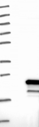 NBP1-90342 - Beta-Synuclein / SCNB