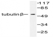 NBP1-51173 - TUBB / TUBB5
