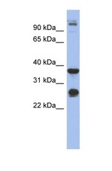 NBP1-57933 - Biglycan