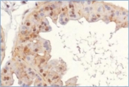 NB600-336 - c-Myc Epitope Tag (EQKLISEEDL)