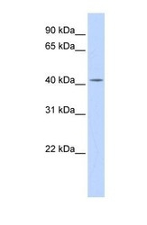 NBP1-55231 - Dedol-PP synthase
