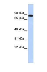 NBP1-59227 - Desmocollin-3