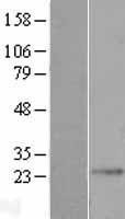 NBL1-10070 - dynein, cytoplasmic 2, light intermediate chain 1 Lysate