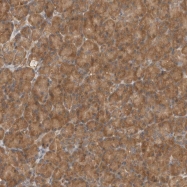 NBP1-84869 - EIF3E / EIF3S6