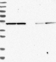 NBP1-84869 - EIF3E / EIF3S6
