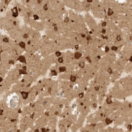 NBP1-84865 - EIF4G3