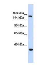 NBP1-57533 - EIF4G3