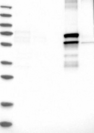 NBP1-84865 - EIF4G3