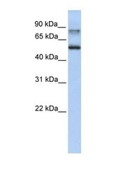 NBP1-56656 - Epsin-1