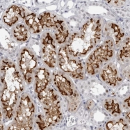 NBP1-90588 - Espin