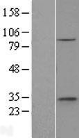 NBL1-10354 - ethanolamine kinase Lysate