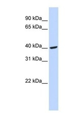 NBP1-69291 - Fibrinogen gamma chain